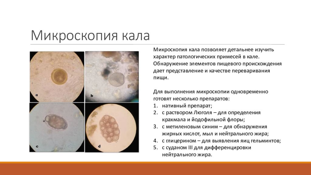 Растительная клетчатка неперевариваемая в кале у взрослого. Микроскопия кала с Суданом 3. Микроскопия кала нативный препарат. Копрология кала микроскопия. Атлас копрограмма микроскопия.