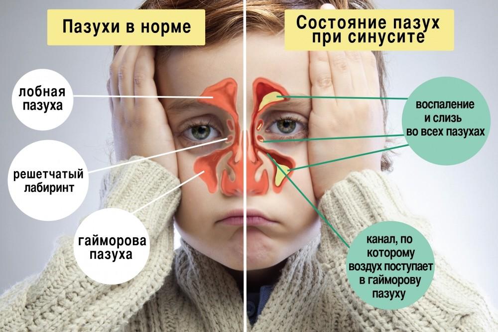 Узнайте всё о том, какими бывают болезни лошадей Полный перечень, причины и возбудители, симптоматика Как лечить заболевшую лошадь
