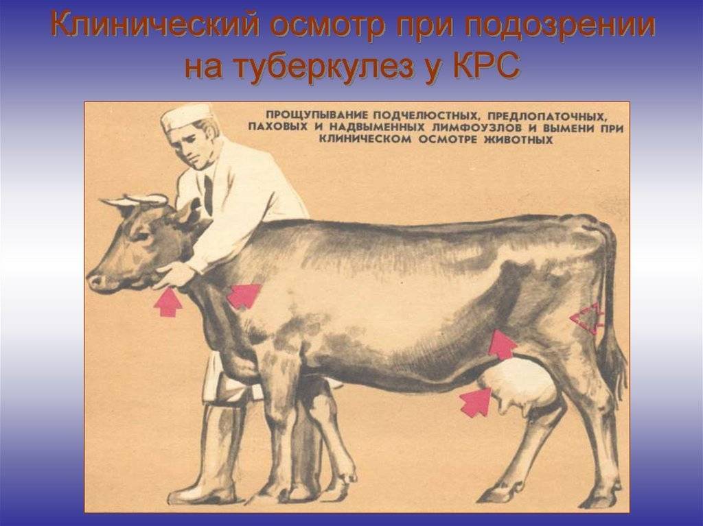 Бруцеллез у человека