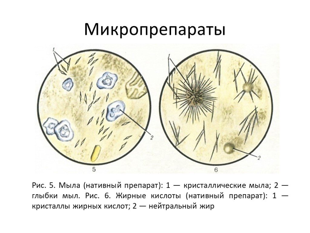 Растительная клетчатка в копрограмме. Микроскопия кала атлас копрология. Микроскопия кала клетчатка. Микроскопия кала мышечные волокна. Микроскопия кала соединительная ткань.