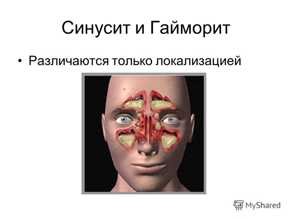 Воспаление кишечника - симптомы, лечение, диагностика и профилактика