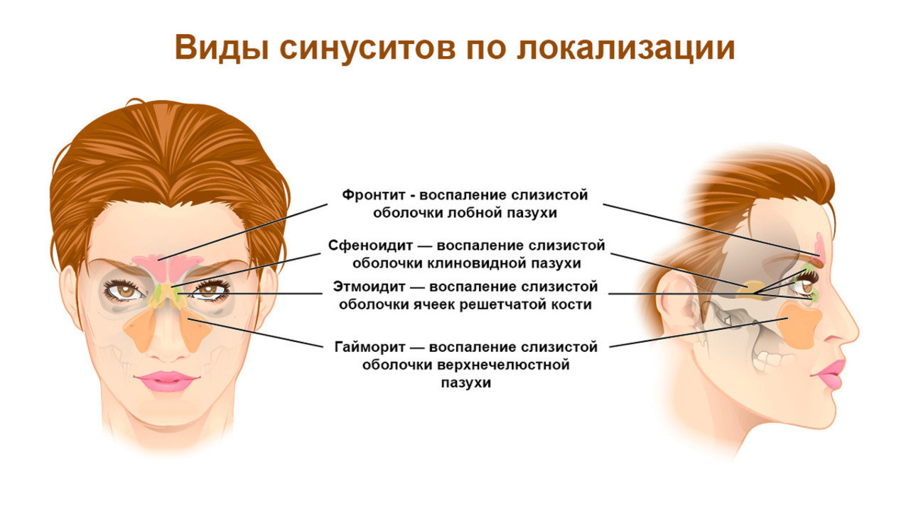 Болезни лошади (инфекционные, незаразные, инвазионные): диагностика, симптомы и лечение